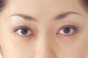 子宮膣部びらんになる前に、出来ることはあるの