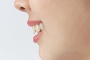 レーザー治療をおこなうなら兵庫県へ